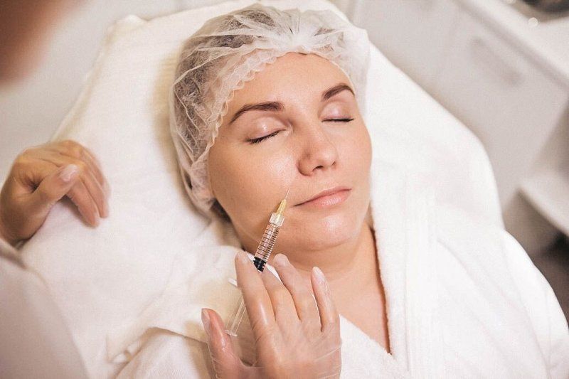 Does Restylane Fillers Address Fine Lines Around The Mouth?