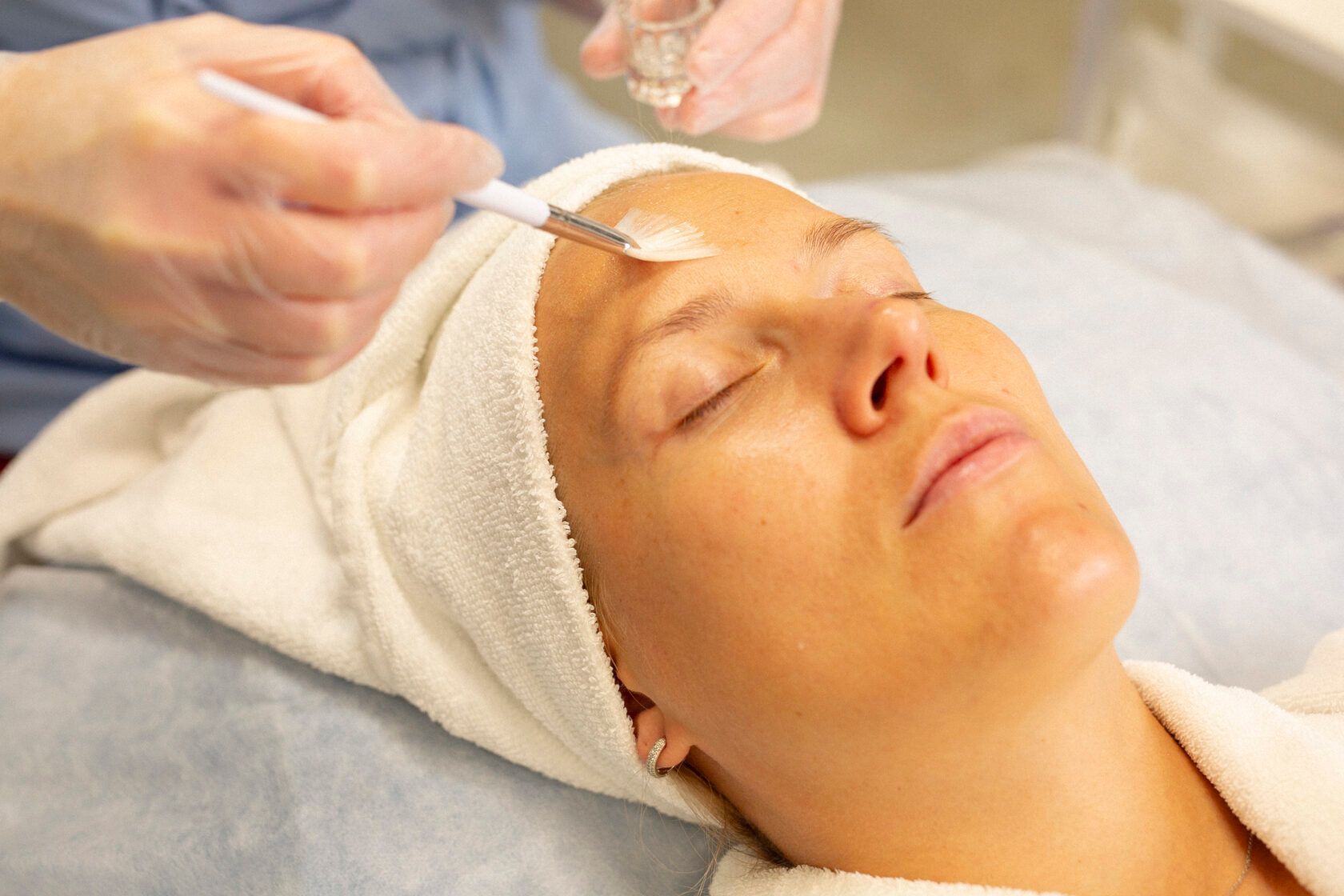 What Makes Cosmelan Peel Popular for Brighter Skin Appearance?