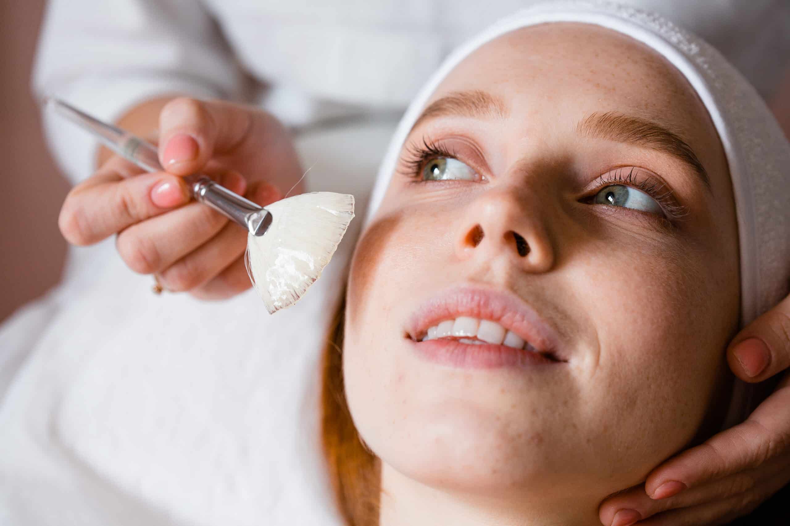 Is Chemical Peel Suitable for Improving Facial Skin Clarity?